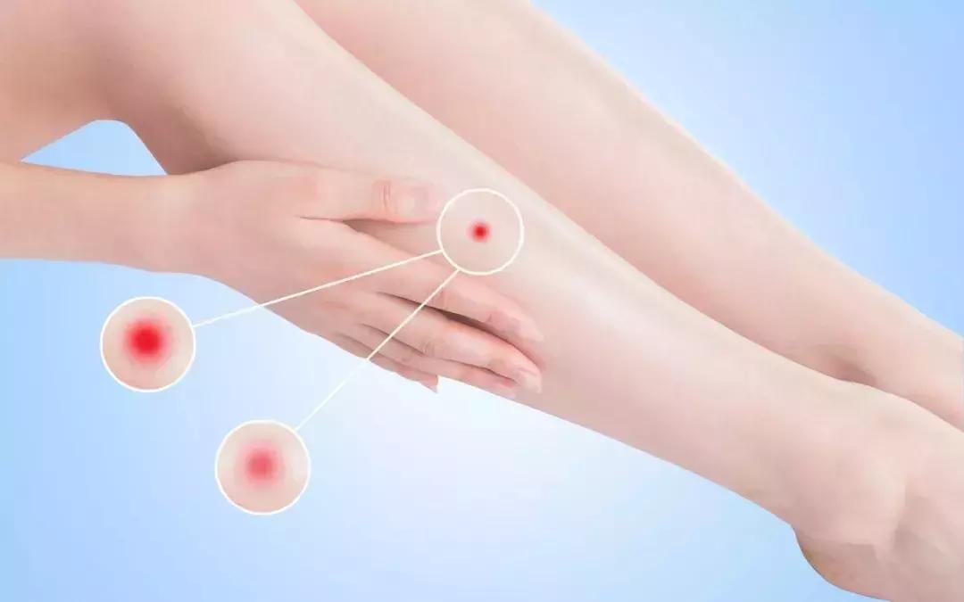 梅雨季容易得什么病,梅雨季节要当心