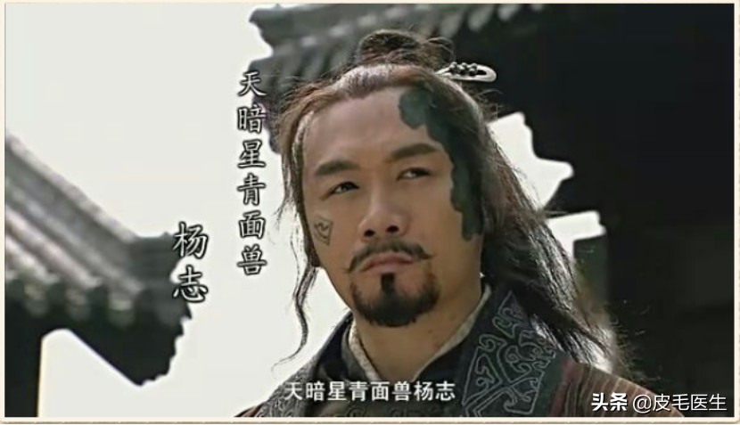 忍不住想给梁山好汉，送一台激光治疗仪