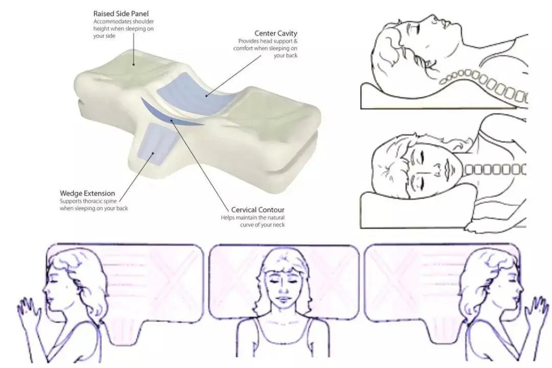 一招消除落枕,4个小妙招缓解落枕痛