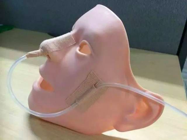 留置胃管的护理记录怎么写,出院后胃管护理宣教