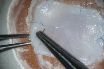 鸡蛋皮缝合手术,缝合鸡蛋膜视频教程