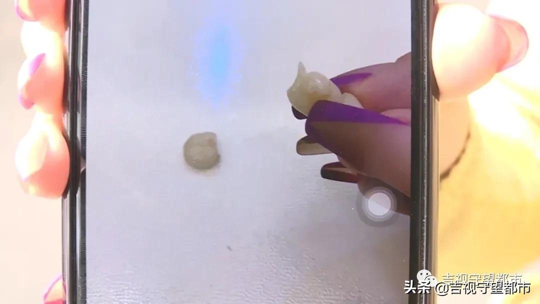 烤瓷牙里都烂成渣渣了,烤瓷牙太厚了要重新做吗