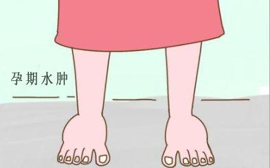 孕晚期水肿要吃冬瓜吗,孕晚期水肿需要催生嘛