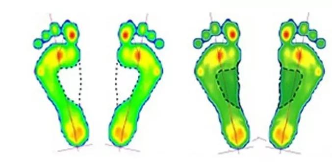 nba球星的鞋垫有什么特别之处,nba球星为什么要把鞋垫取出来