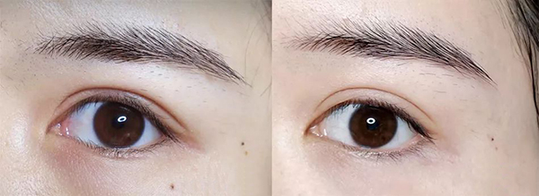 能放进包包的“美容院”,随时淡纹护眼,素颜美女少不了它