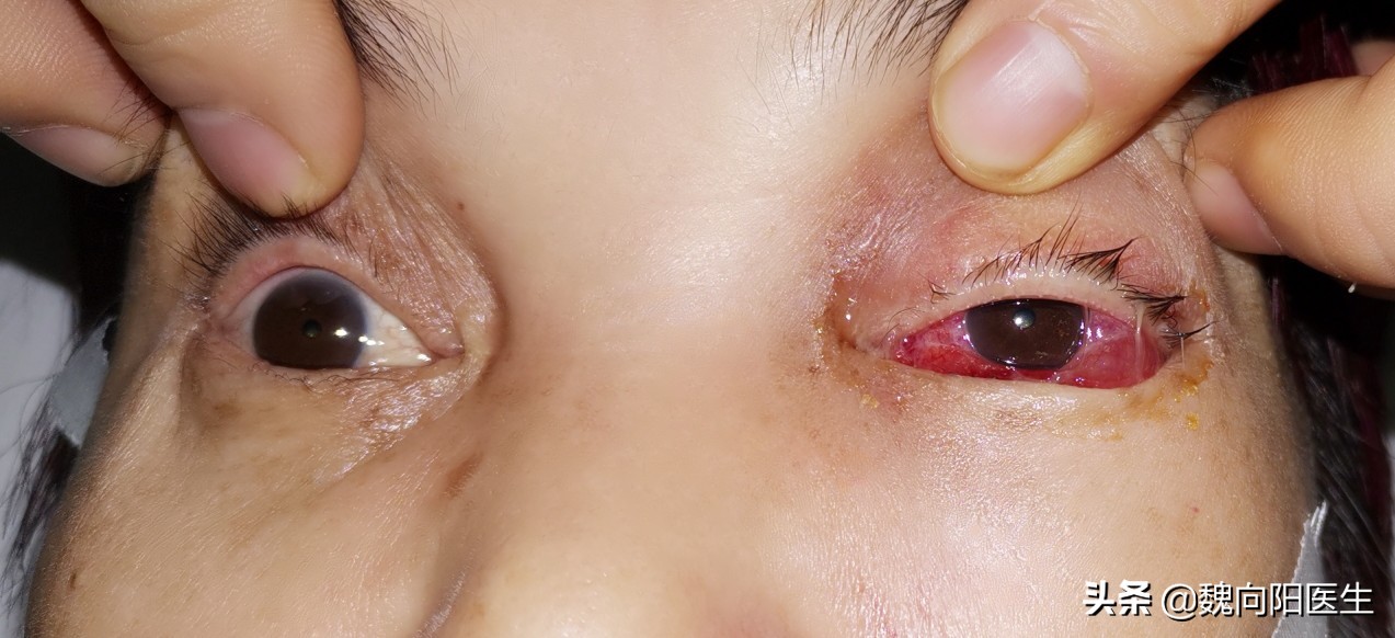 后脑勺着地很危险的,为什么后脑勺着地危害大