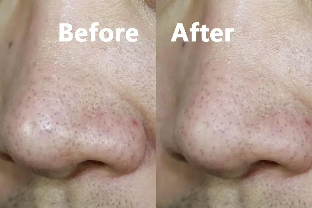 谣言粉碎机,谣言粉碎机真的有效果吗