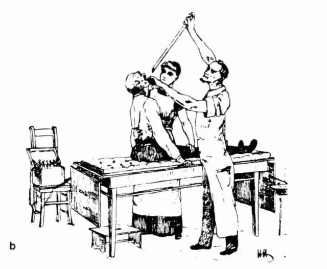 从吞剑、胃镜到管道检测：内窥镜的前世今生