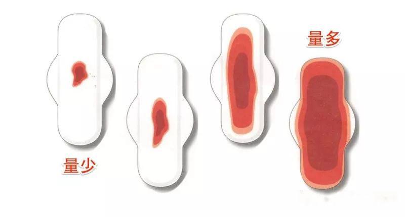 女人月经量多如何调理,女孩子月经量很大用什么方法