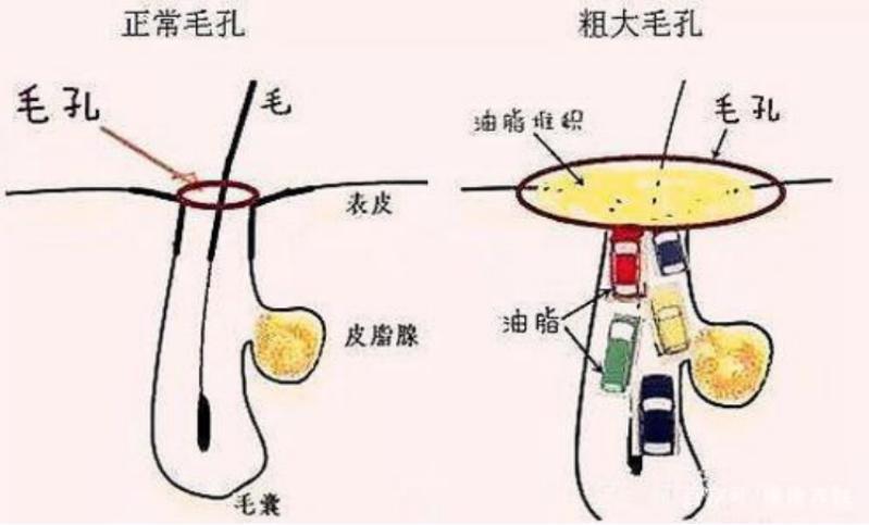 改善皮肤暗黄毛孔粗大的面膜推荐,改善皮肤暗沉毛孔粗大护肤品套装