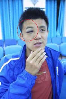 韦世豪恶意伤人事件,韦世豪足球事件