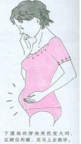 子宫平滑肌肉瘤结局,什么是子宫内膜癌肉瘤