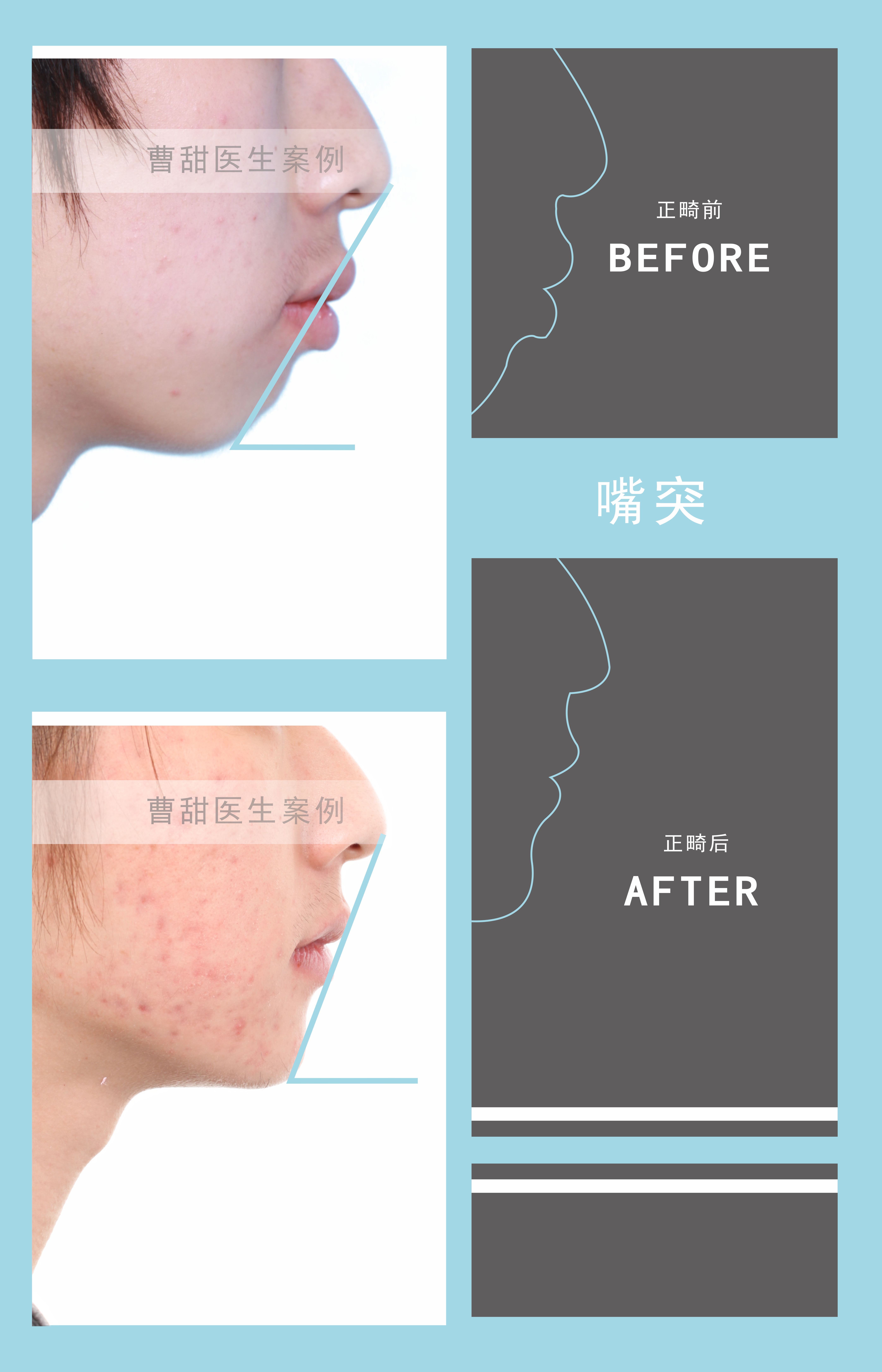 西安哪里有做牙齿矫正,在西安哪里可以做牙齿矫正