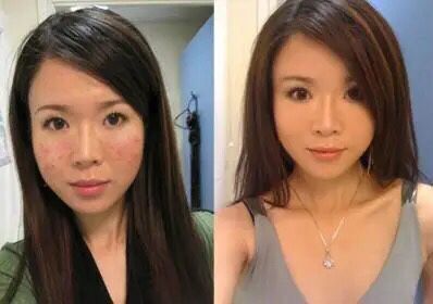 王鸥谈打了瘦脸针,王鸥打过瘦脸针吗