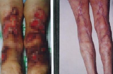 无精症患者的新希望,卵巢癌最新治疗新希望