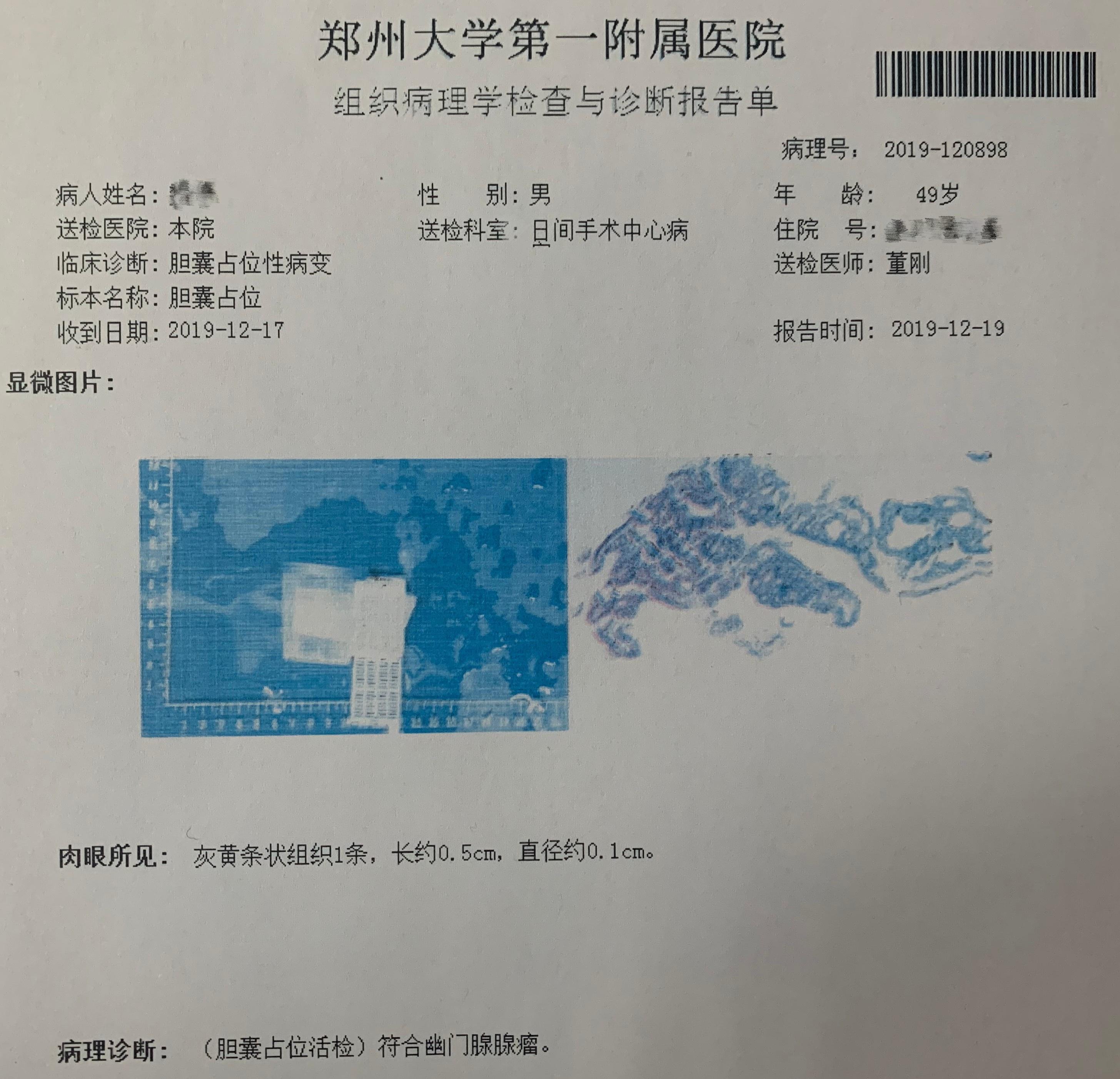 胆囊息肉消融保胆有效吗,胆囊息肉消融保胆有用吗