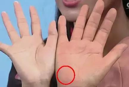 手诊10种常见病从手上就能看出来,如何辨别手掌的健康
