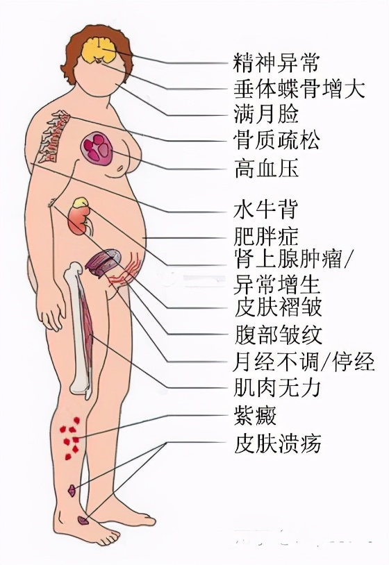 打封闭针可治骨关节炎吗,骨刺关节炎怎么治疗效果最好