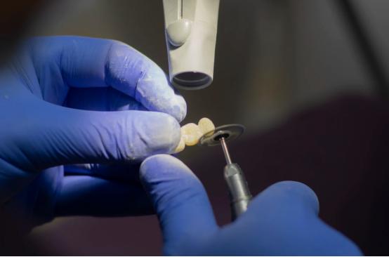 拔完智齿的当天你是怎么度过的,拔完智齿当天吃东西口腔怎么清洁