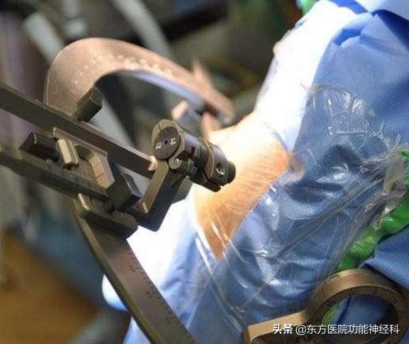 抽动秽语综合征的药物治疗,抽动秽语综合症哈尔滨治疗