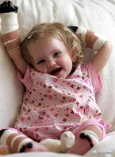 13岁无臂女孩成最酷“美妆博主”:不惧命运的人太酷了