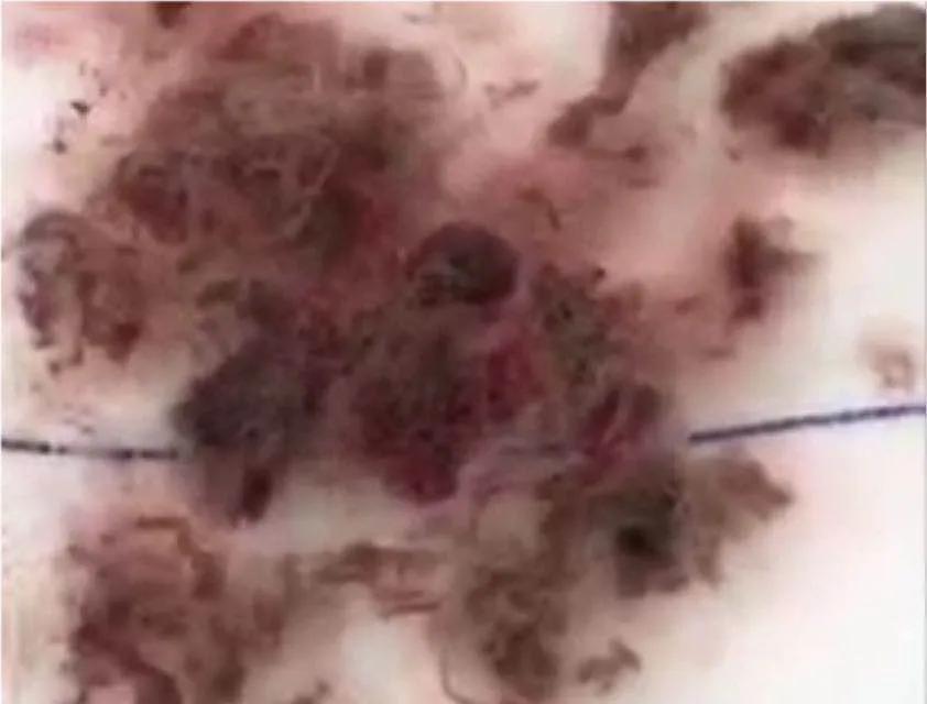 【新闻聚焦】7岁女童患妇科病吓坏妈妈　原因竟是塞进了异物临沂市妇幼保健院专家:幼儿性教育宜早不宜迟!