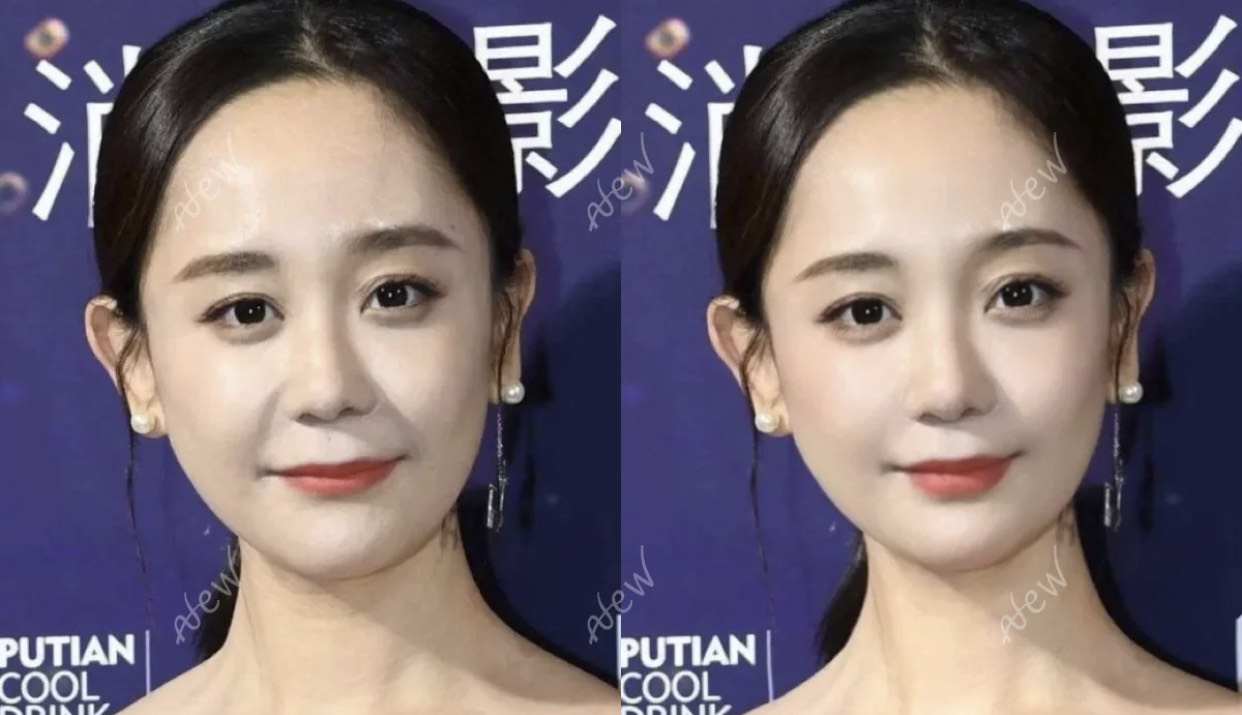 一笑眼下就有皱纹怎么办,从脸部看皱纹怎么才算老