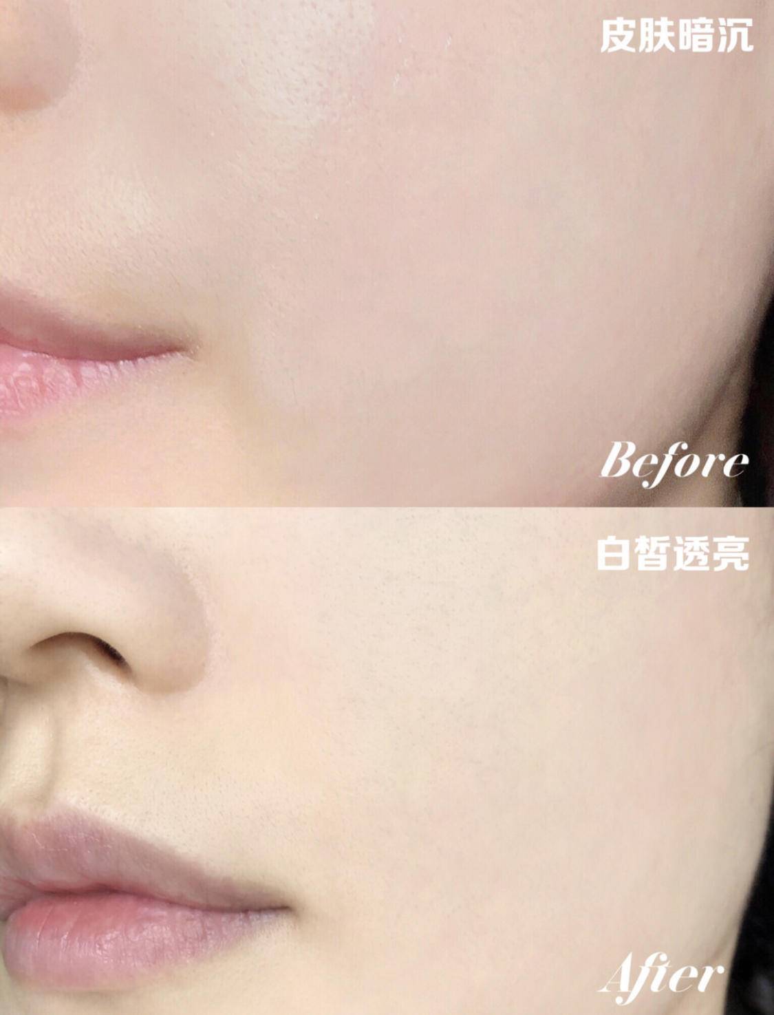 一直在美白却越来越黑的原因,为什么用了美白精华反而黑了