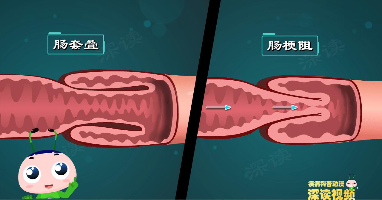 小孩腿上有紫癜发热了怎么办,婴儿腿上有紫癜但没有其他症状