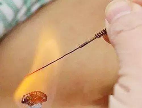 蛇胆膏治疗带状疱疹,蛇胆疮疱疹用什么药最好