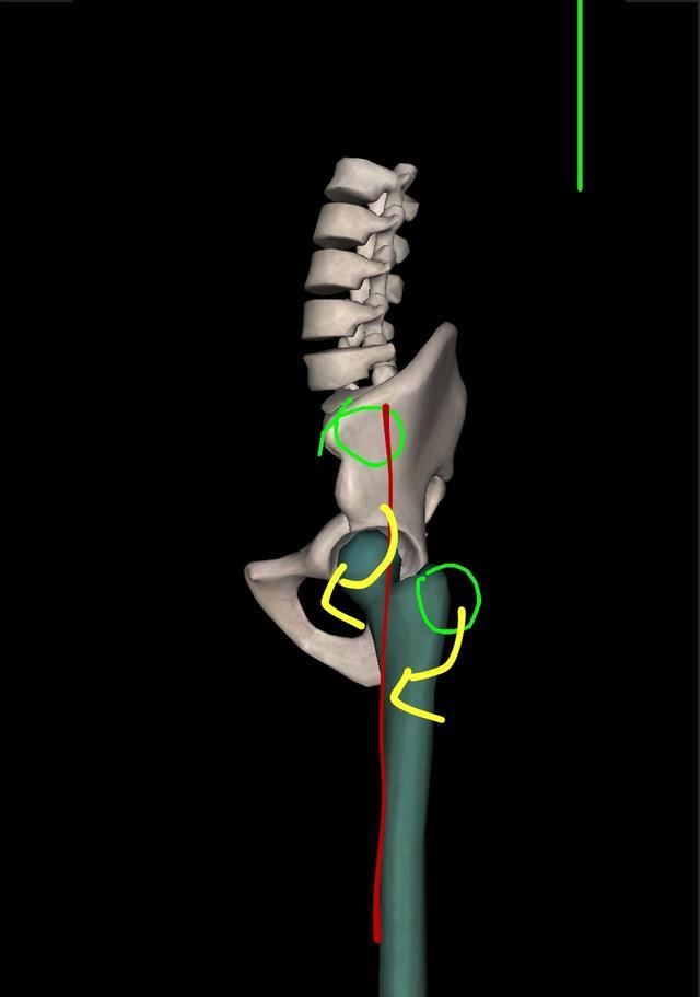 假胯宽臀部塌陷怎么练,改善假胯宽臀部肌肉的瑜伽