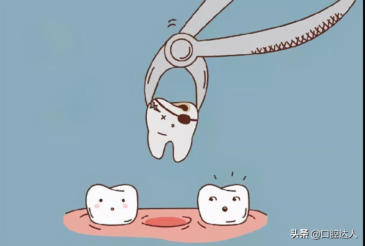 如何才能不拔牙做牙齿正畸,正畸为什么不拔尖牙