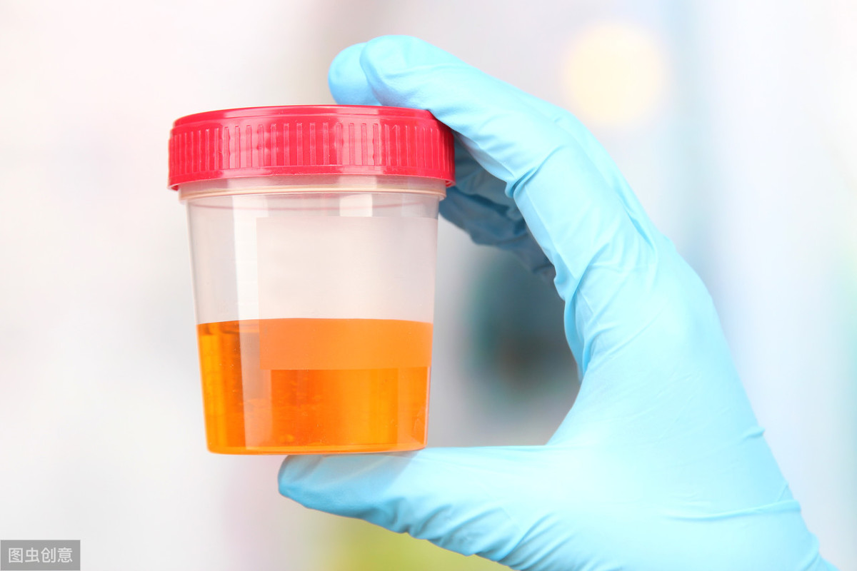 经常喝酒得病什么症状,喝酒容易醉是肾脏不好吗