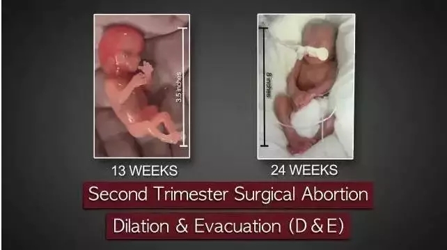 人流最多次案例,20岁女孩人流七次后续