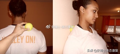 肩胛提肌是松解还是锻炼,运动康复肩胛