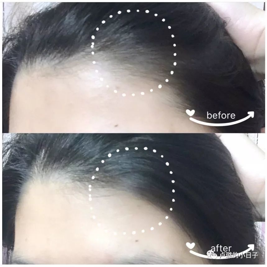 可以拯救发际线的洗发水推荐,拯救干枯毛躁和去屑的平价洗发水