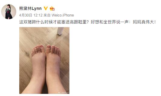 熊黛林晒照暴露生产后遗症,熊黛林产后100天照片