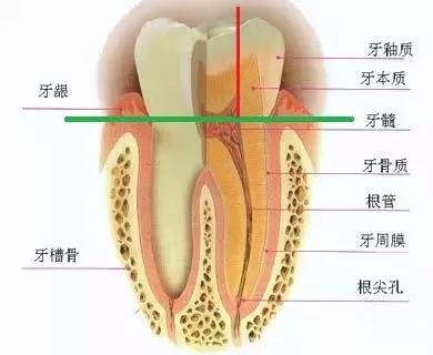 美容冠是什么样,美容冠是什么样的