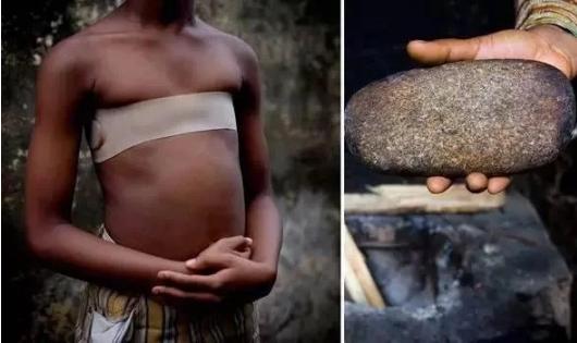 熨平少女胸部！揭秘非洲可怕习俗“烫乳”