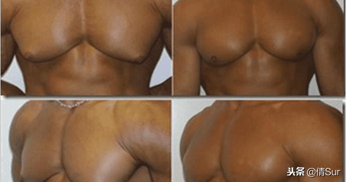 当你的胸比女朋友还大的时候,就要引起注意了……