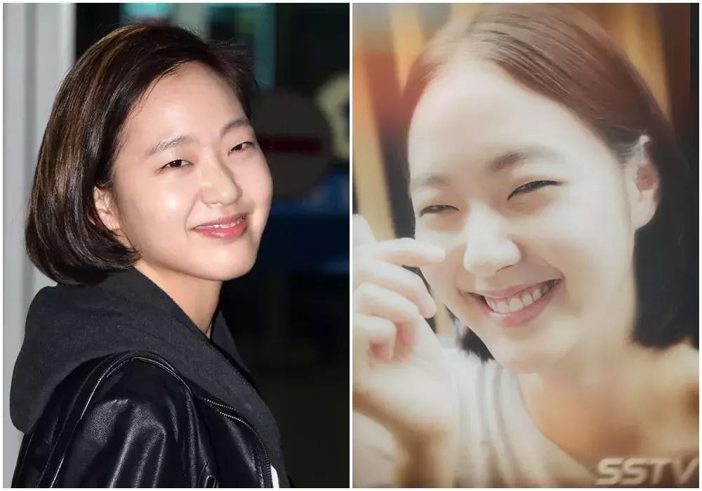 冬天脸肿眼浮肿是什么原因,冬天为啥脸眼皮肿