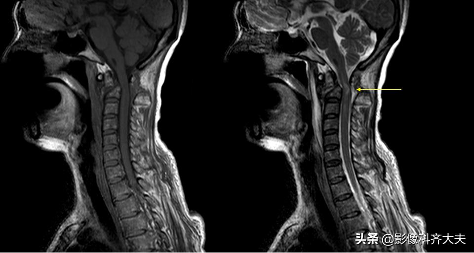 骨折的影像学检查及各自的优势,骨折的影像学愈合标准
