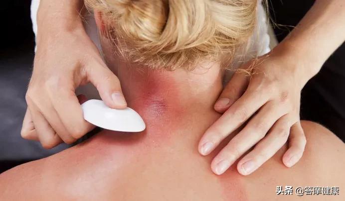 人体保健针灸几大穴,针灸治疗肾虚穴位