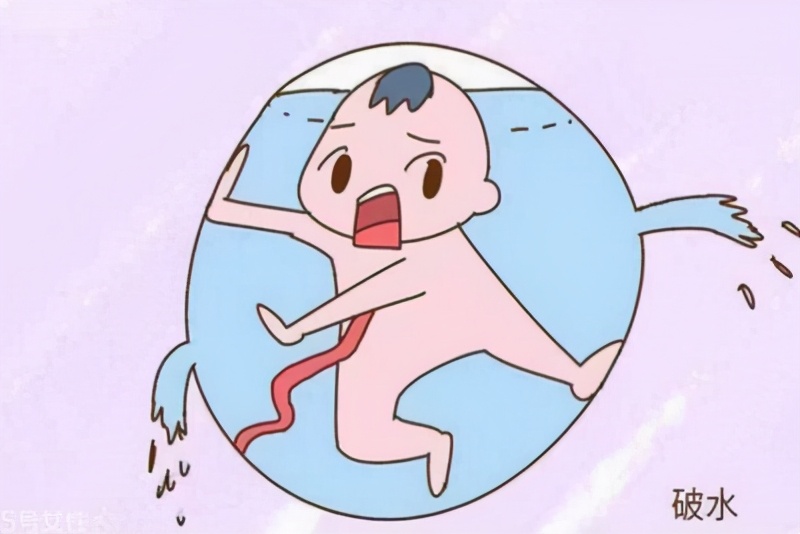 孕妇破水了怎么办，不要慌张，先做好自行处理