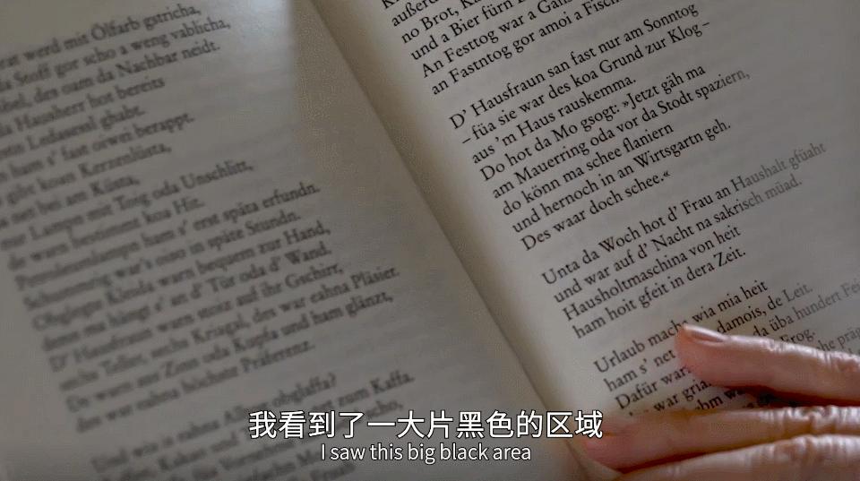 干细胞治疗黄斑变性者自述,黄斑变性失明的悲惨生活