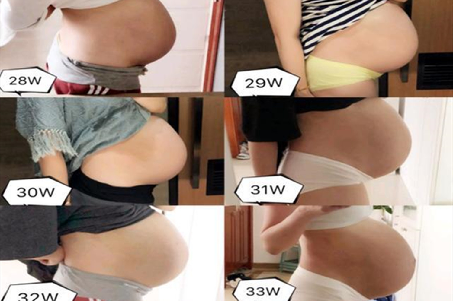 若你是“悬浮肚”，十有八九要剖腹产，想顺产需要先突破两大难题