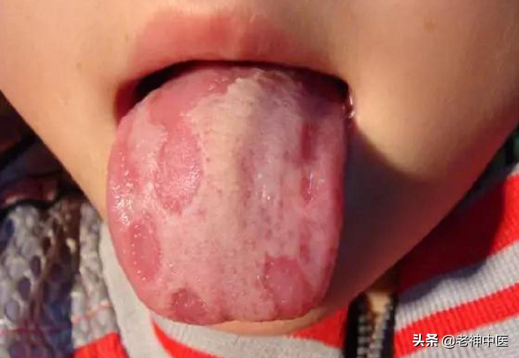 孩子不吃饭地图舌睡觉不踏实,宝宝不吃饭舌苔发黑怎么办