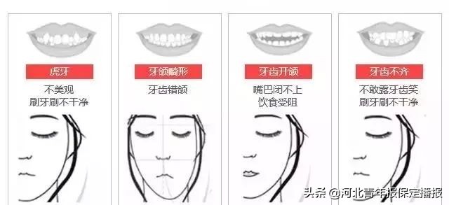 广大口腔公益种牙补贴,领取口腔优惠