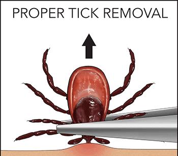 怎么预防在景区被毒虫叮咬,出游当心蜱虫叮咬
