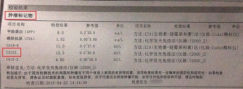 做宫颈分泌物能查出白带异常吗,白带异常要做宫颈筛查吗